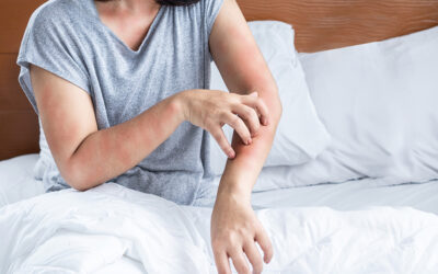 What You Need to Know about Dust Mite Allergies