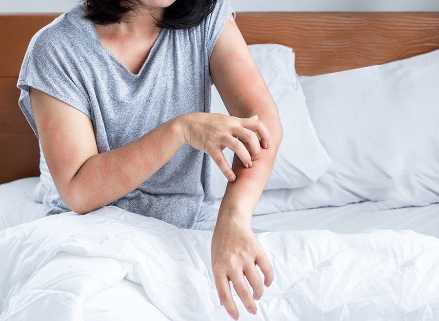 What You Need to Know about Dust Mite Allergies